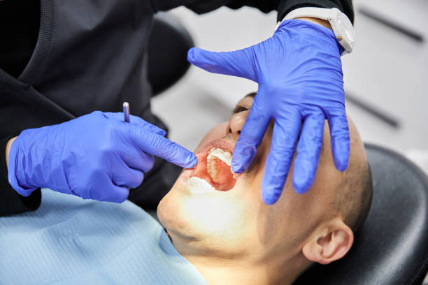 Best Emergency Tooth Extraction in Mariemont, OH
